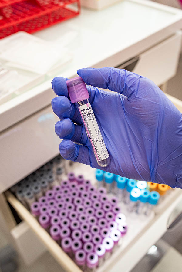 Blodprøvetakingspunkt - profesjonelle laboratorietjenester